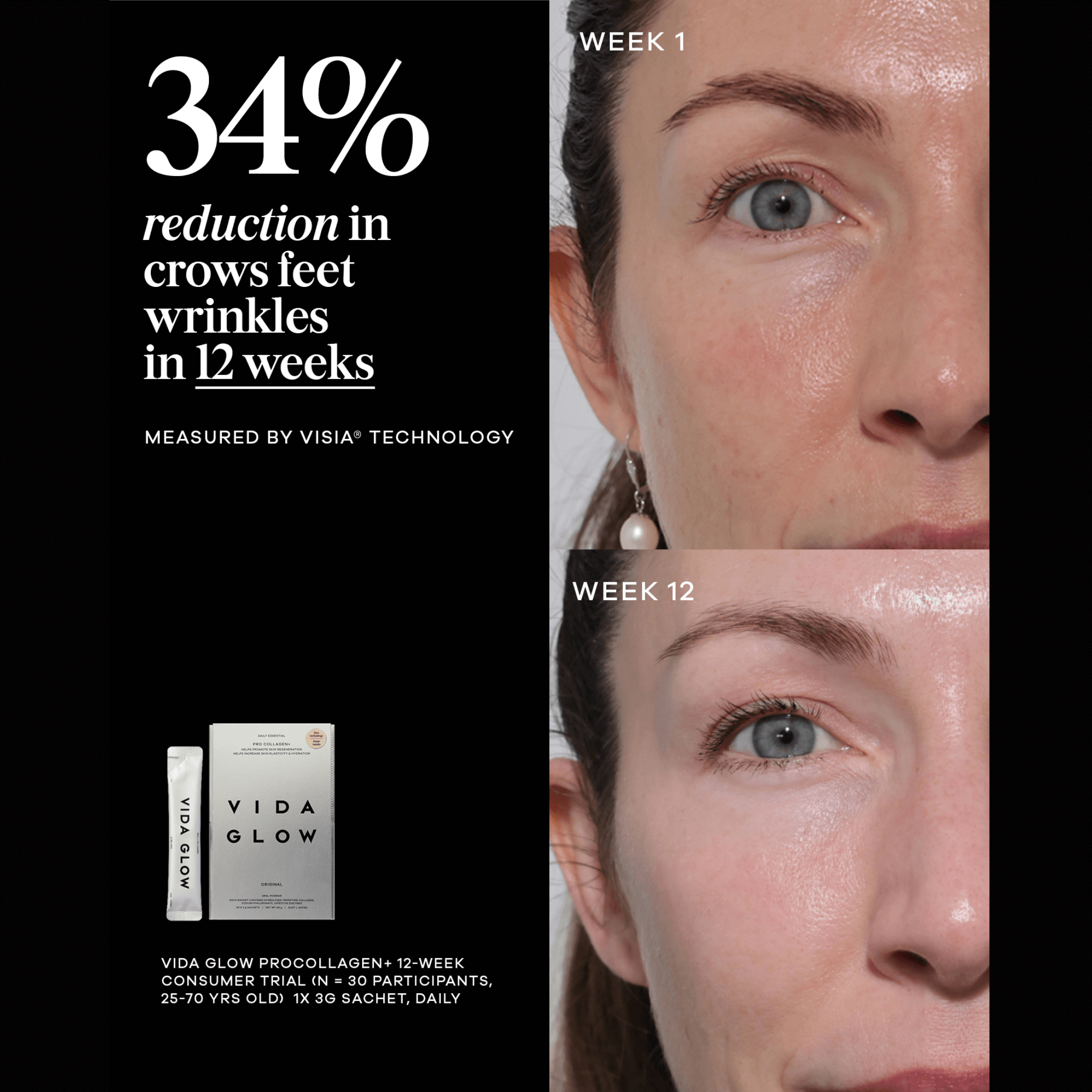 Vida Glow pro collagen before and after photos