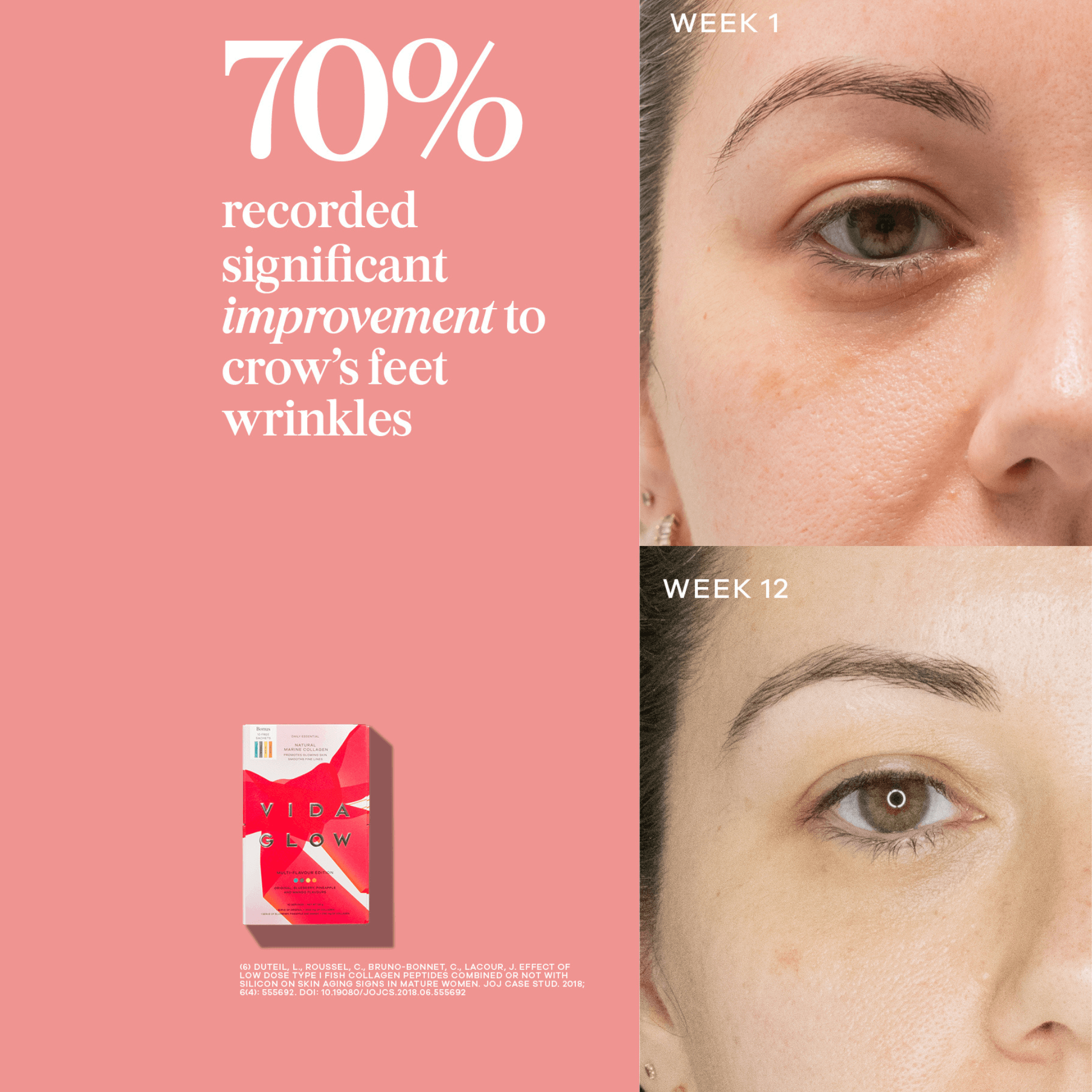 Vida Glow collagen results before and after