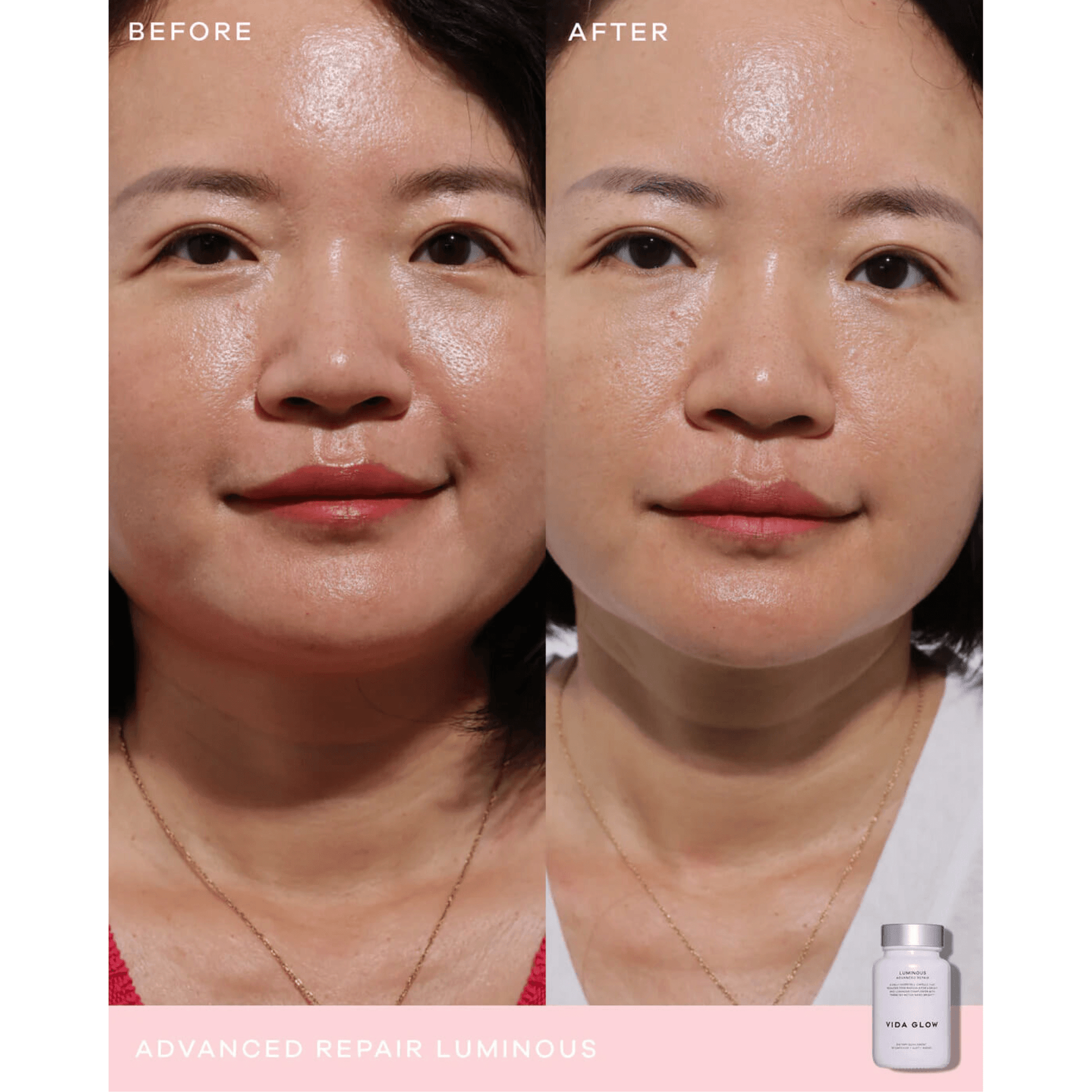 Before and after comparison of a woman's face with a product labeled 'Vida Glow Luminous' on a white background