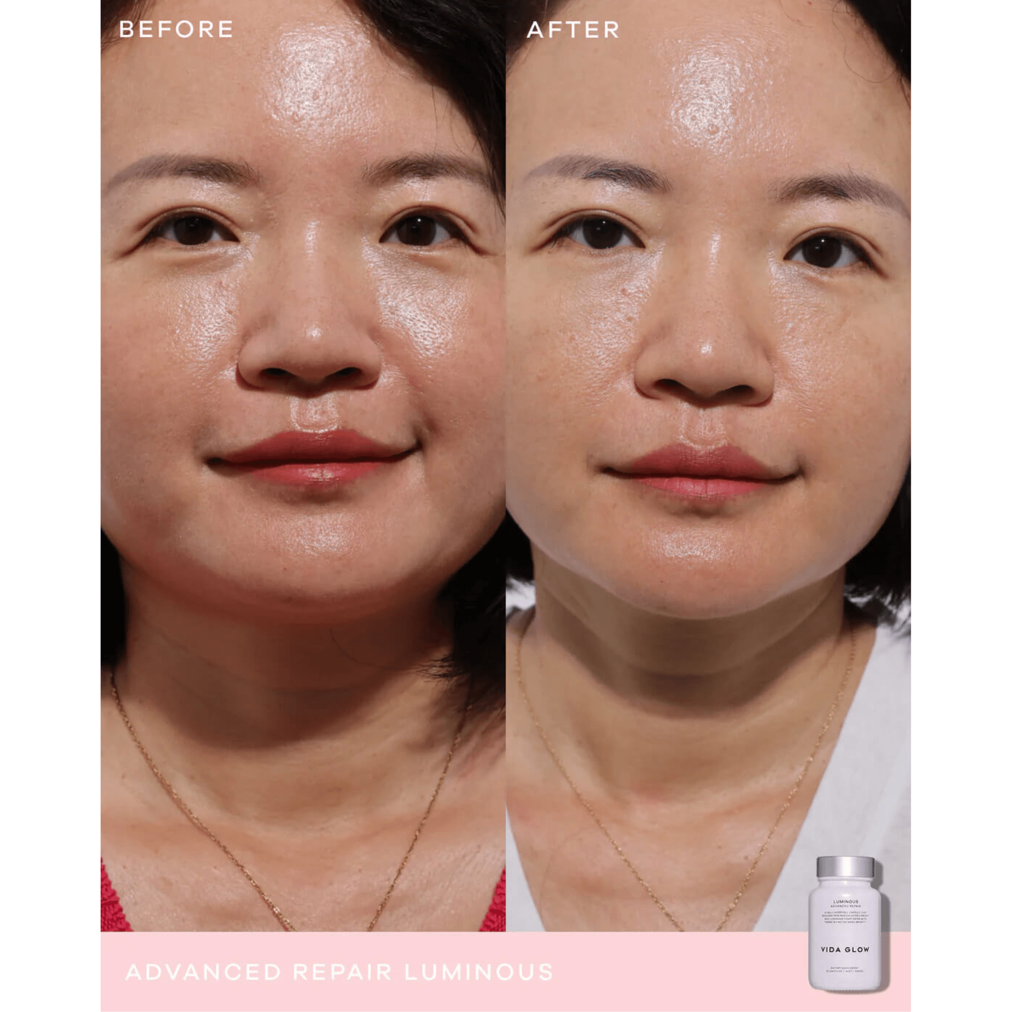 Before and after comparison of a woman's face with a product labeled 'Vida Glow Luminous' on a white background