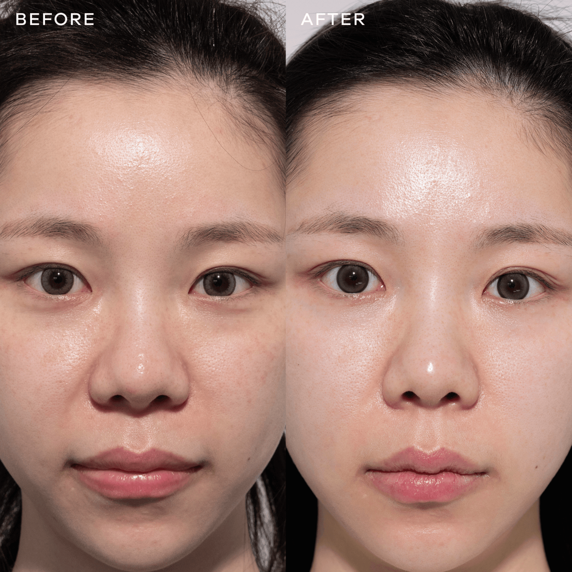 Before and after comparison of a person's face with visible skin improvement after consuming Vida Glow radiance+
