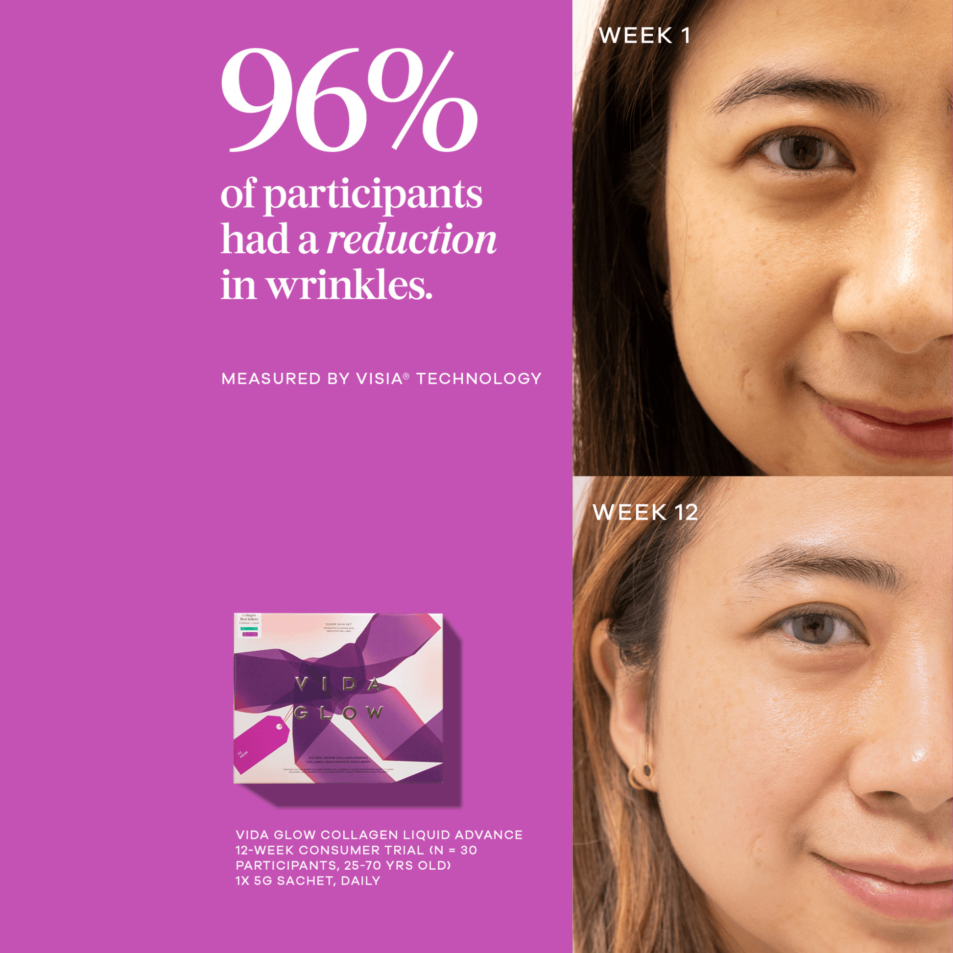 Vida glow collagen limited edition pack benefits before and after results