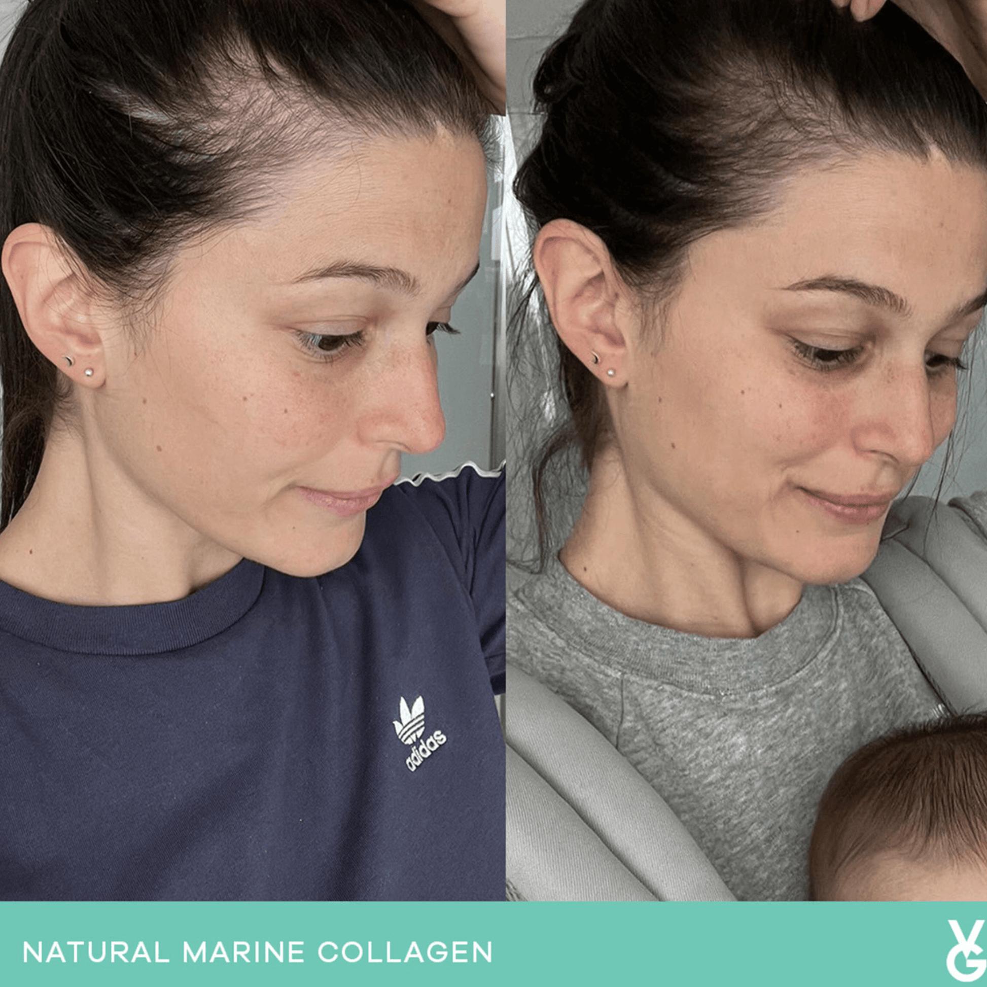 Vida Glow original results before and after