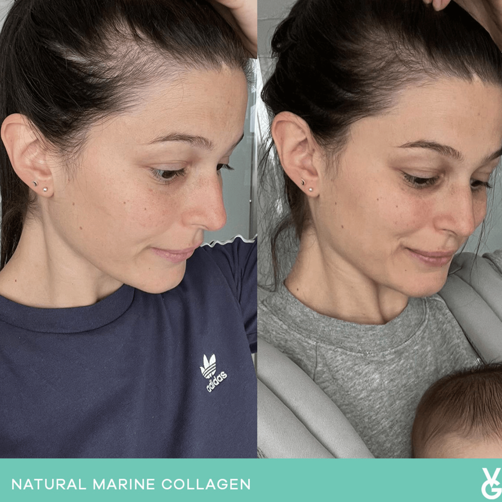 Vida Glow original results before and after