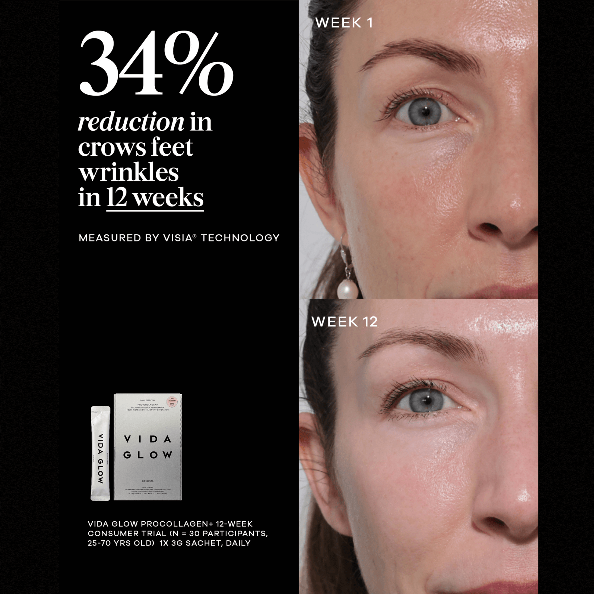 Vida Glow pro collagen before and after photos