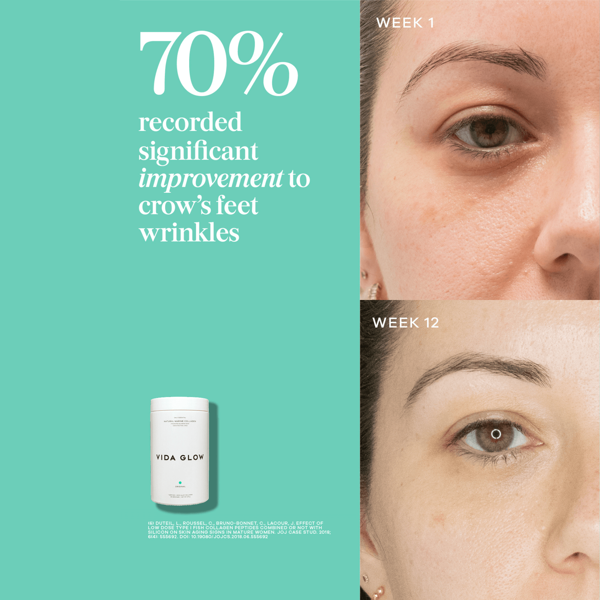 Vida glow results before and after with text